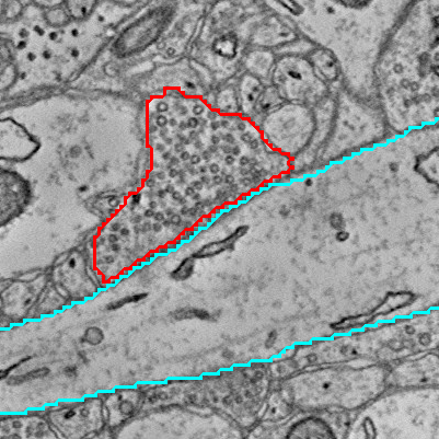 Segmentation overlay using distinct (unmerged) outlines